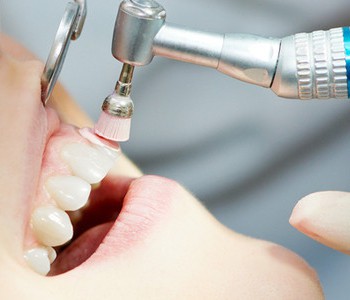 Чистка зубов профессиональными методами - Стоматологическая клиника "Дента-проф" р.п. Шаля